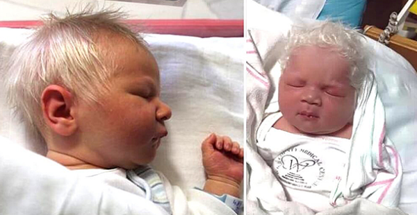 This Baby Was Born With White Hair When Doctors Tells The Reason His Mom Is Speechless